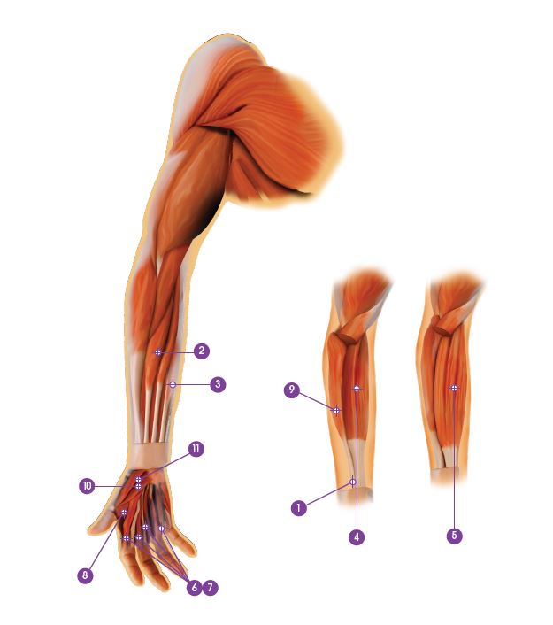 Arm